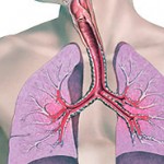 lung thumb