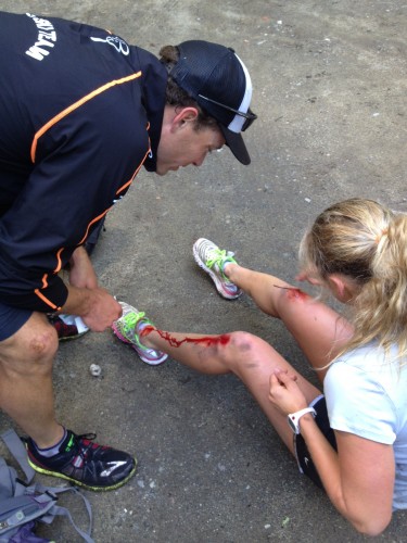 Jessie Diggins (Stratton Mountain School T2/U.S. Ski Team) with some bloody knees after tripping on an OD trail run in the Adirondacks near Lake Placid, N.Y., in early September. USST women's coach Matt Whitcomb (l) inspects the damage.