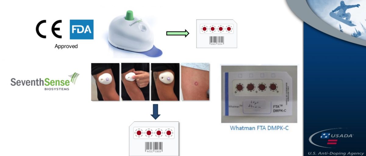 A Possible New AntiDoping Tool DriedBloodSpot Testing